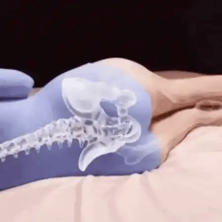 Il cuscino che tiene le gambe allineate e toglie pressione dal nervo